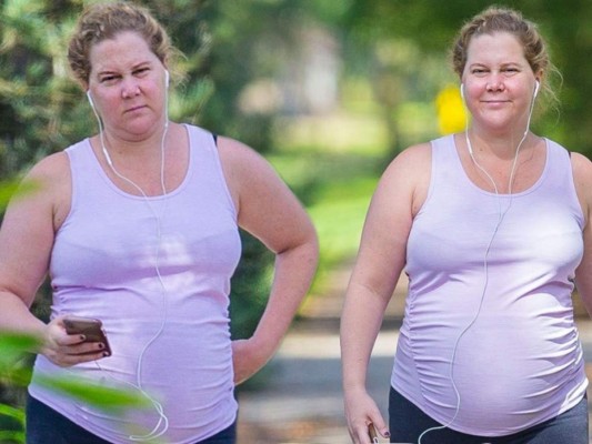Amy Schumer