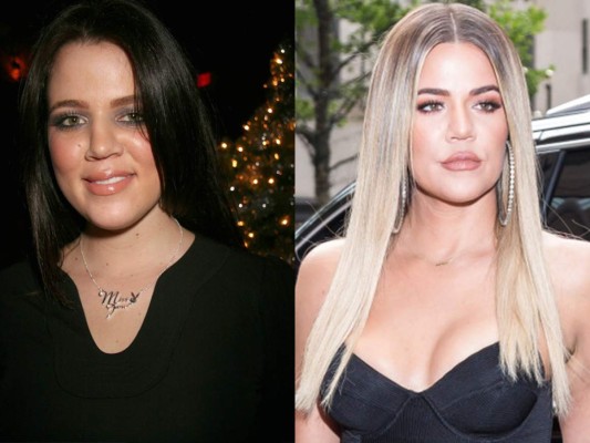 Khloé hace a un lado los rumores y asegura que su transformación ha sido dieta y mucho ejercicio. Aparte de una obvia rinoplastía.