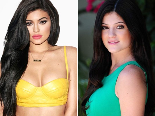 Tal parece que Kylie Jenner ha decido reconstruir todo su físico.