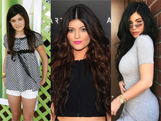 La fenomenal transformación de Kylie Jenner