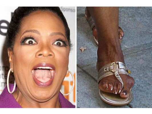 10 celebridades con pies feos