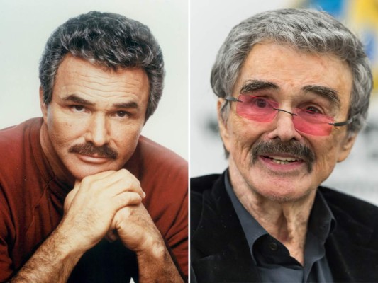 El veterano actor Burt Reynolds se ha sometido por años a rellenos de botox, la blefaroplastia y a cirugía de párpados.<br/>