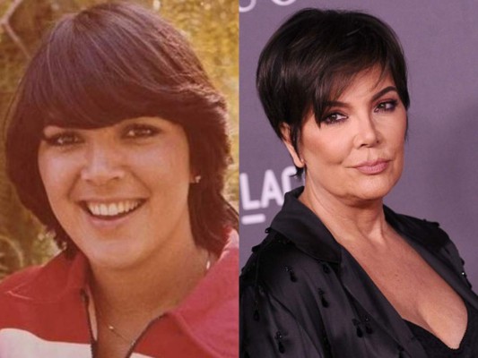 La 'momager' Kris no tiene problemas con hablar de sus cirugías desde los 80´s cuando comenzó con implantes de senos, un lifting grabado en el programa hasta su reciente rejuvenecimiento facial.