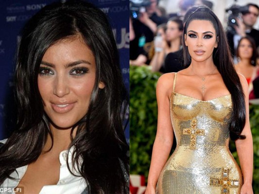 Kim ha confesado tratamientos no invasivos como procedimientos laser para la piel en diferentes zonas de su cuerpo, a pesar de las sospechas ella niega todo rumor de cirugía.