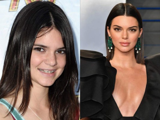 Aun con rumores de sus labios Kendall es considerada la más natural del clan Kardashian-Jenner
