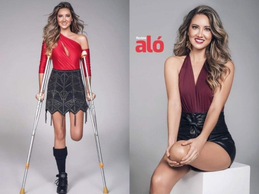 Ex Miss Colombia protagoniza portada luego de amputación de pierna