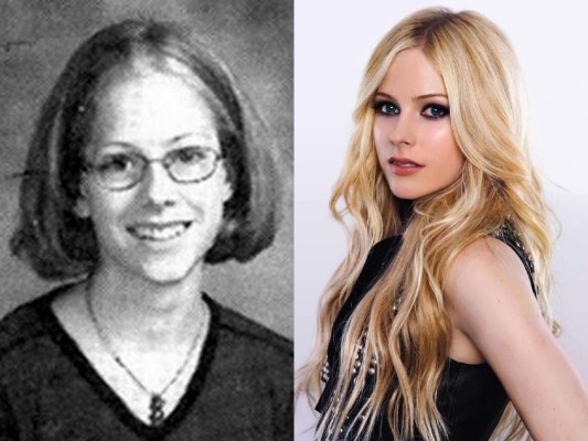 El antes y después de estas hermosas celebridades  