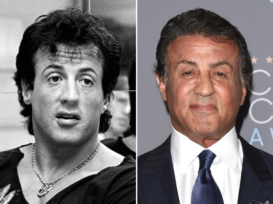 No se sabe cuántos rounds ha perdido en la sala de cirugía Sylvester Stallone. El famoso actor esta irreconocible y con sobrepeso.