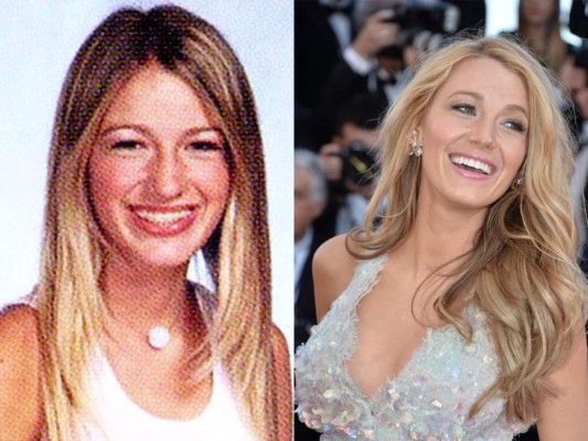 El antes y después de estas hermosas celebridades  