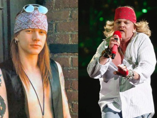 Axl Rose