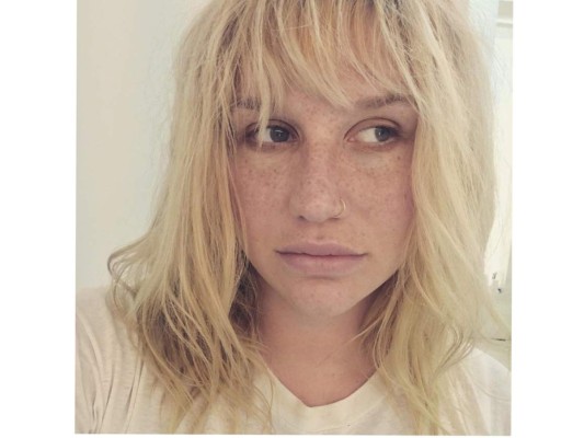 Kesha