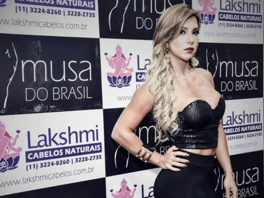 Raquel Santos<br/>La concursante del certamen Musa de Brasil decidió realizarse una cirugía estética en el rostro, pero perdió la vida tras complicaciones en la operación.<br/>