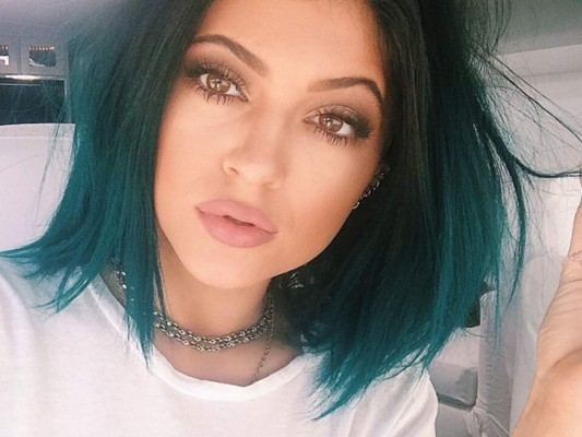 Kylie Jenner confiesa la verdad sobre sus labios