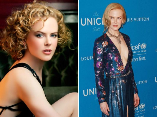 Nicole Kidman. La actriz abusó del botox y las cirugías y ahora luce irreconocible.