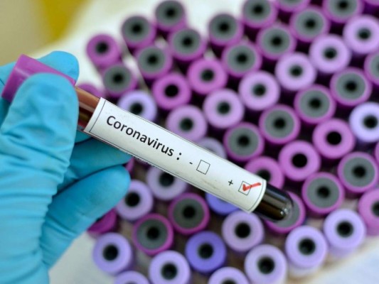8 Avances tecnológicos para combatir el coronavirus