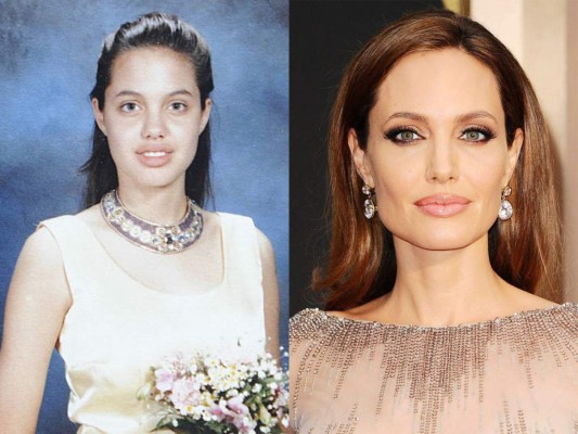 El antes y después de estas hermosas celebridades  