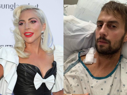 Paseador de perros de Lady Gaga rompe silencio sobre asalto