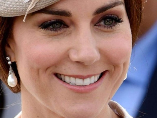 ¿La Duquesa de Cambridge Kate Middleton se puso bótox? 