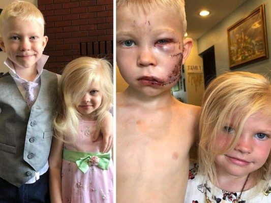 Bridger Walker: el niño que salvó a su hermana del ataque de un perro  