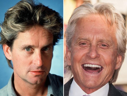 Michael Douglas no duda en someterse a los retoques estéticos. Todo para recuperar así la antigua vitalidad de su rostro.