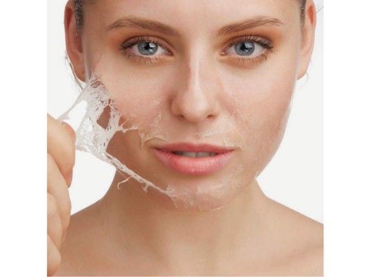 La descamación de la piel puede infectarse si se araña o intenta pelar con fuerza la piel.