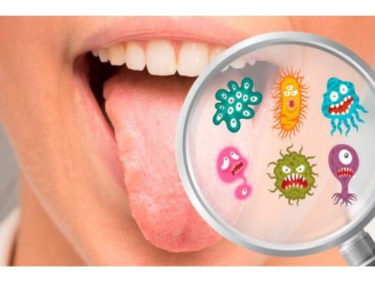 Microorganismos en la boca: Los microorganismos en la boca como hongos y bacterias se deben a enfermedades autoinmunes o a una mala higiene y esto puede provocar manchas blancas u oscuras. En estos casos se recomienda mejorar el cepillado dental y de la lengua para decir adiós a todos los restos alimenticios.
