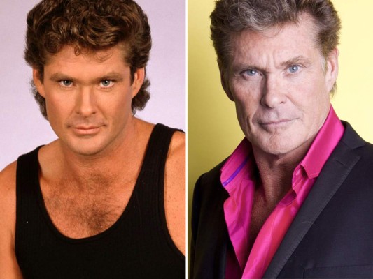 David Hasselhoff ha envejecido y admitió haber hecho uso del botox. La estrella de Baywatch se ha sometido no solo a una sino a varias cirugías plásticas.