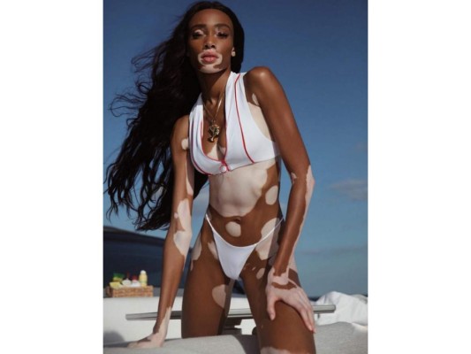 La carrera de Winnie Harlow