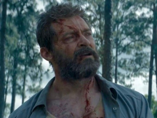 9. Durante la filmación de 'Logan' Hugh, ponía piedras reales dentro de sus zapatos para dar alusión de que su personaje estaba acabado.