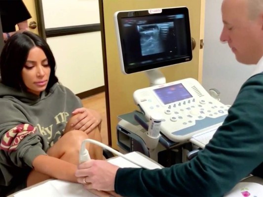 ¡Kim Kardashian no tiene Lupus!
