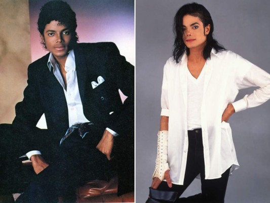 Uno de los grandes íconos de la música también se han sometido a radicales cambios. Michael Jackson cambio de color de piel y llegó hasta a desfigurar su rostro. Fue un verdadero camaleón adicto a las cirugías plásticas. Muchos llegaron incluso a decir que se ensañó con su rostro, tratando de borrar aquellos rasgos negros de los cuales se avergonzaba y por los cuales su mismo padre se burlaba, como por ejemplo su nariz ancha y el acné de su adolescencia.