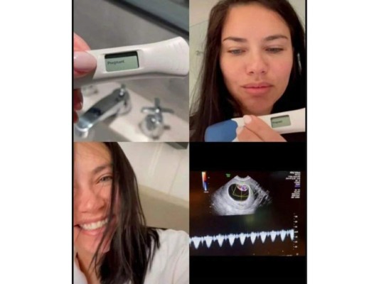 Adriana Lima publicó como primer TikTok el momento en el que reveló a su novio Andre Lemmers la noticia de su embarazo.