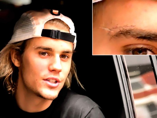 ''Grace'' El nuevo tatuaje en la cara de Justin Bieber