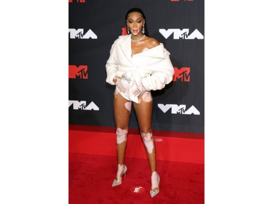 Winnie Harlow.