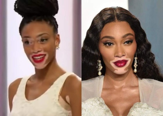 La carrera de Winnie Harlow