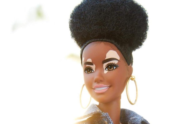 Para el año 2019 Mattel lanzó una muñeca inspirada en Winnie Harlow entre las Barbies Fashionistas.