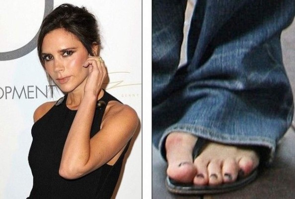 10 celebridades con pies feos