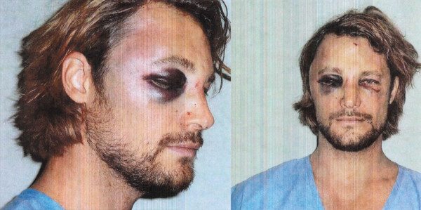 Gabriel Aubry cuenta su versión sobre la pelea con Olivier Martínez