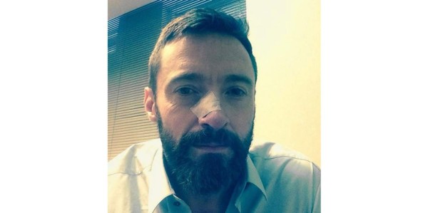 Hugh Jackman, tratado por cáncer de piel por segunda vez