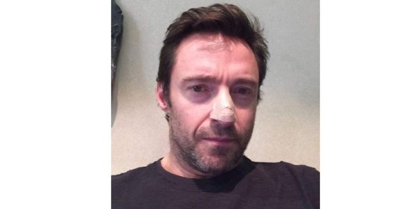 Hugh Jackman, tratado por cáncer de piel por segunda vez