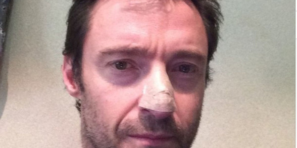 Hugh Jackman y el cáncer de piel