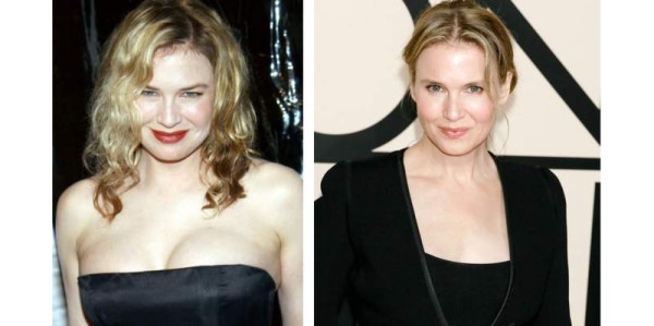 2. Renée Zellweger. Luego del éxito del filme 'Bridget Jones', en muy poco tiempo la actriz pasó de ser talla 14 a talla 4, pese a esto la actriz es objeto de críticas debido a su cambio radical.