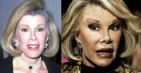 Joan Rivers: Una mujer polifacética