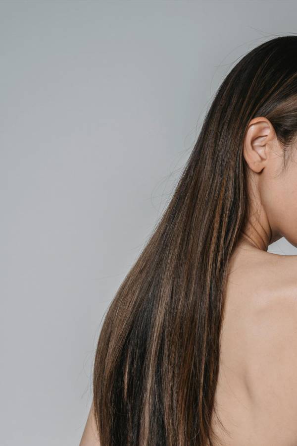 Existen tratamientos específicos para combatir este problema. Foto cedida por Studio F