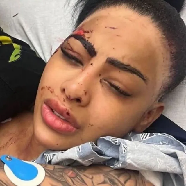 [Video] Tekashi 6ix9ine comparte video donde es agredido físicamente por Yailin