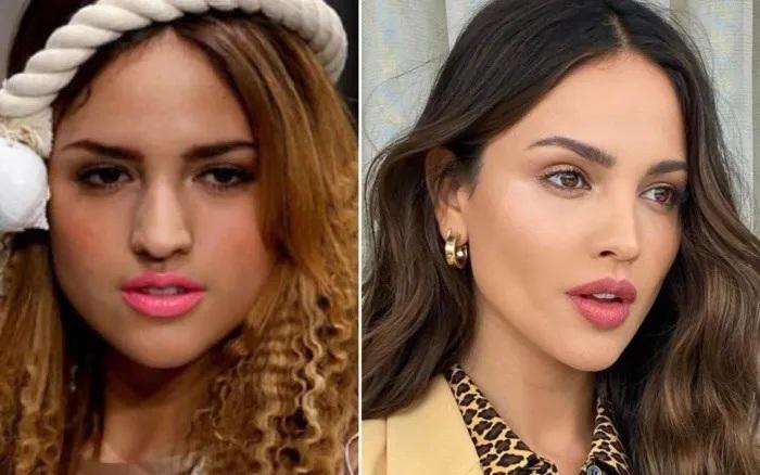 15 Famosos que se han sometido a cirugía estética