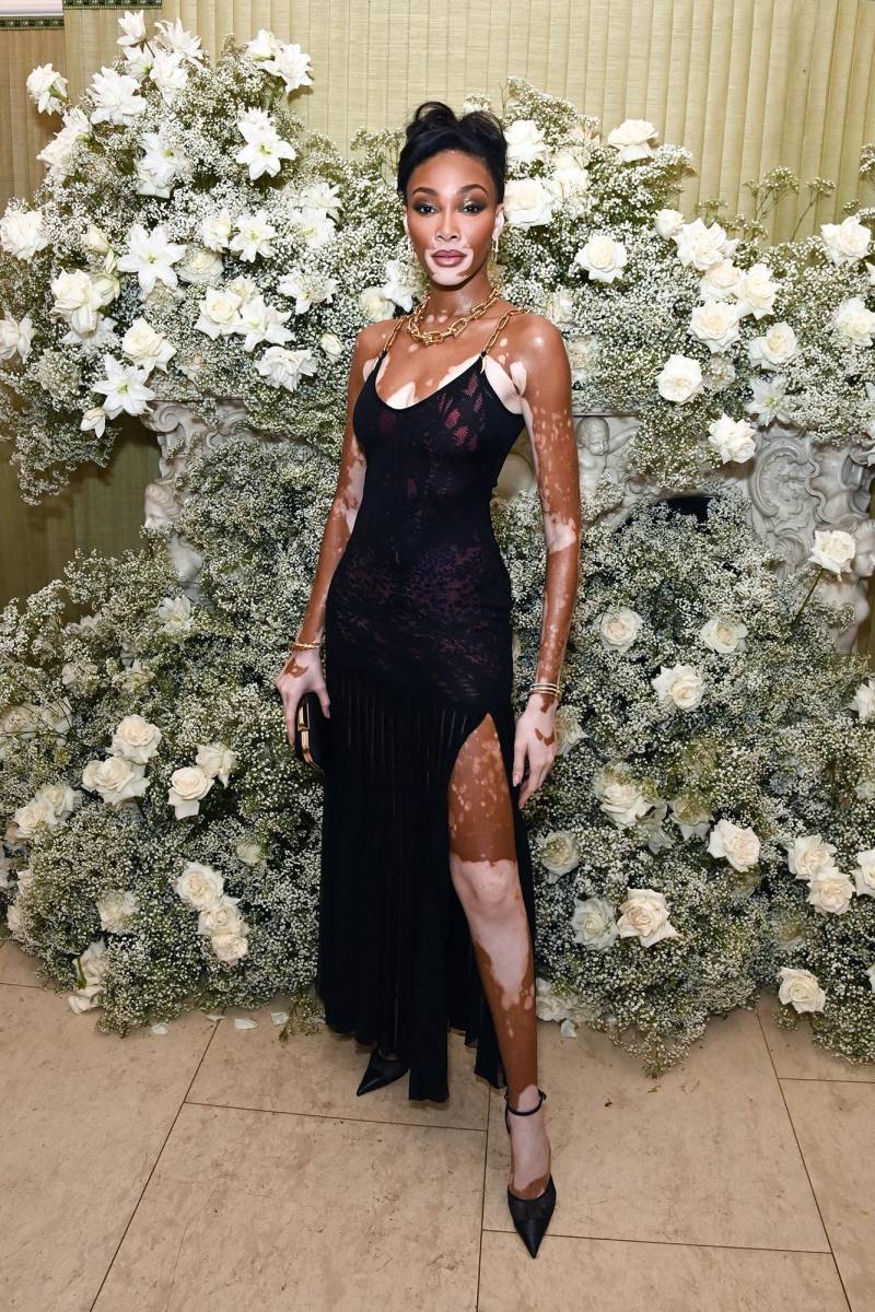 Winnie Harlow.