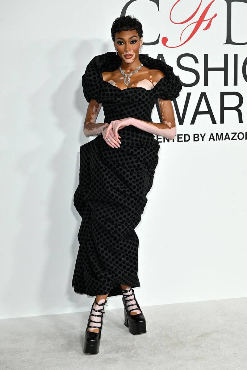 Winnie Harlow 