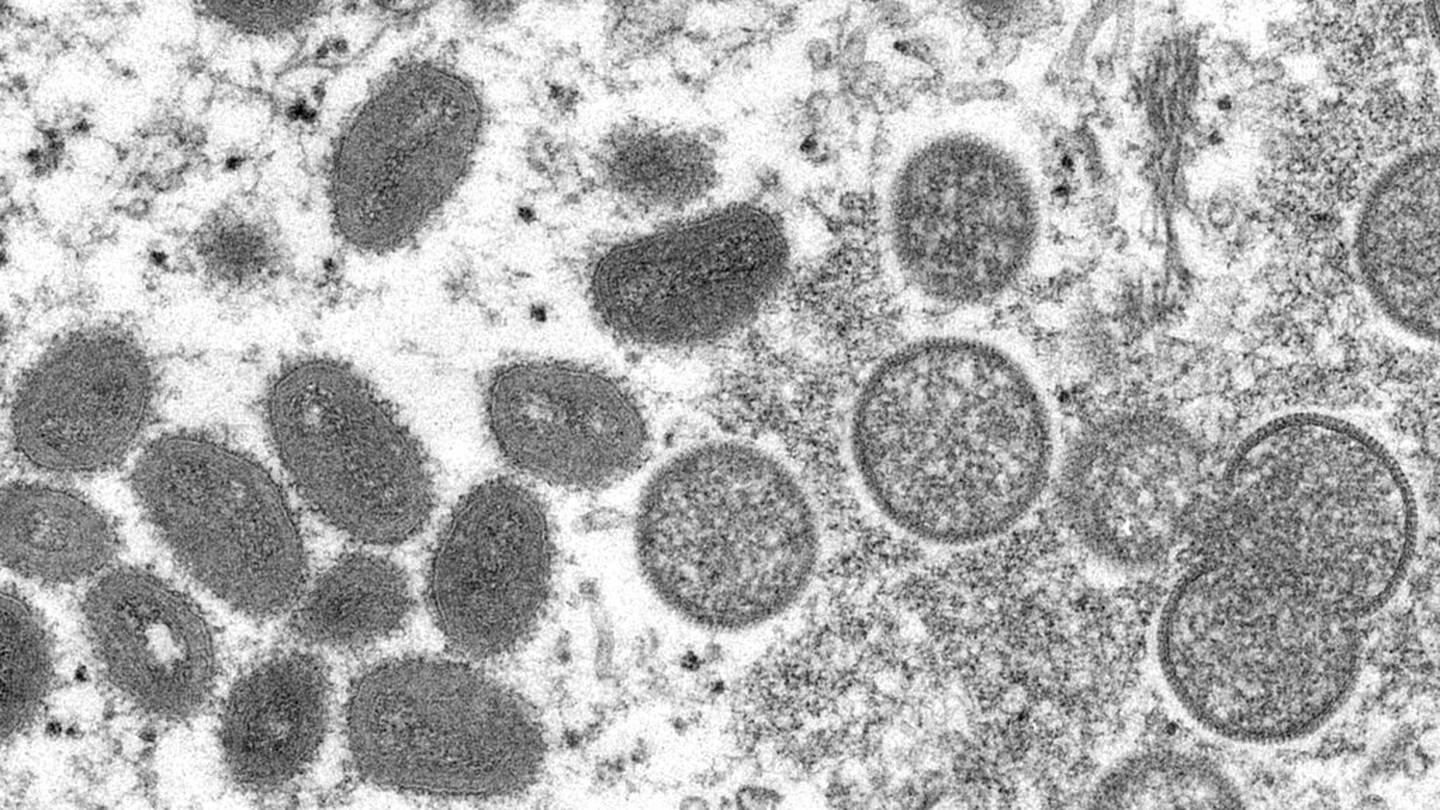La viruela del mono vista en microscopio. $!La viruela del mono vista en microscopio.